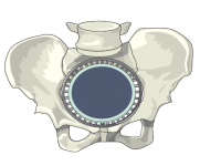 Ist Trampolintraining gut oder schlecht für meinen Beckenboden?